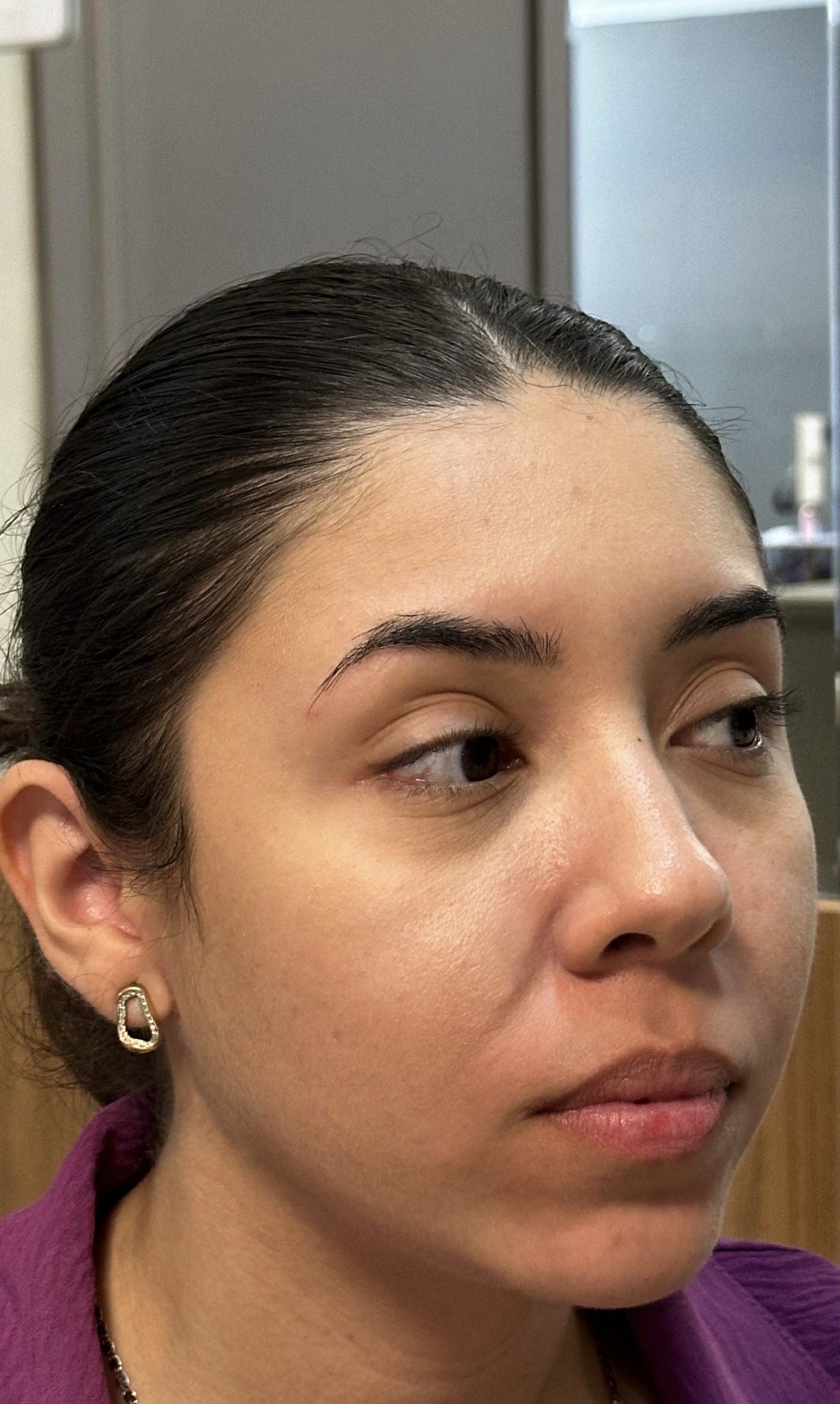 Perfil e contorno, antes